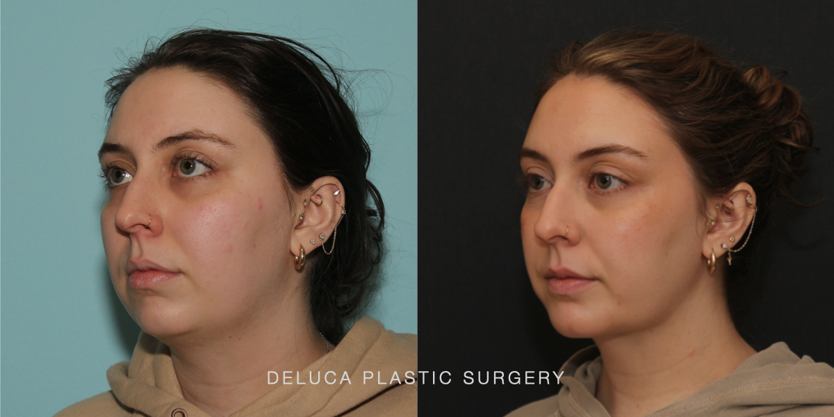DPS Before and After 25186.002